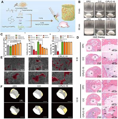 Advances in materials used for minimally invasive treatment of vertebral compression fractures